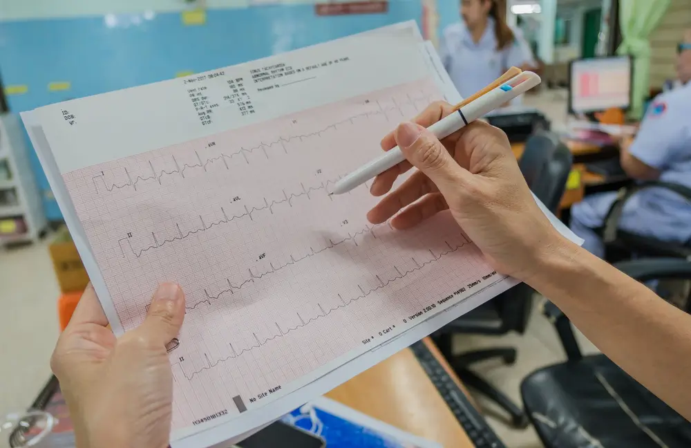 Cardiologia - Interpretação de Laudos ECG, M.A.P.A., Holter e Teste Ergométrico Cardiologia - Interpretação de Laudos ECG, M.A.P.A., Holter e Teste Ergométrico